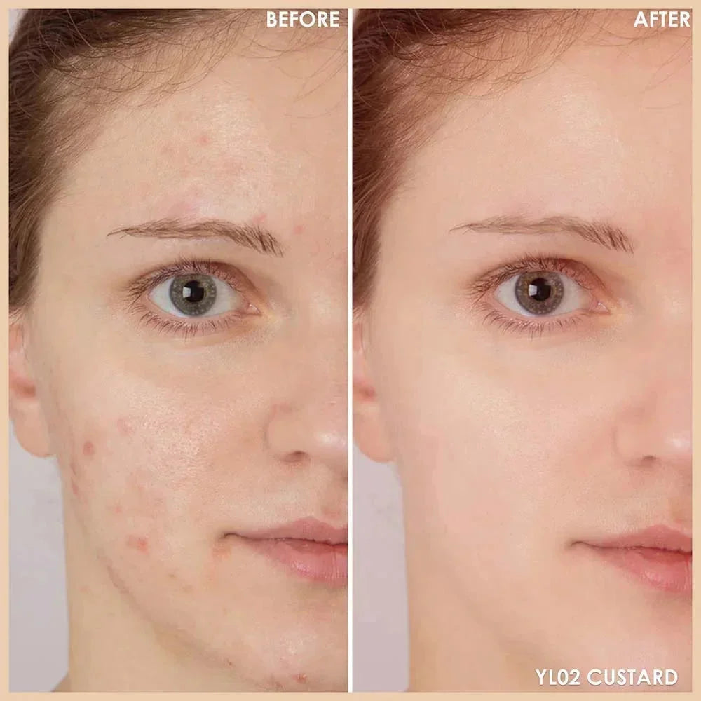 Fix Corrector Concealer Stick #NE01 Sundae